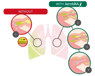 Without and with aerobika device