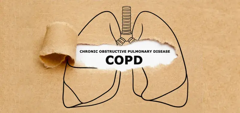 copd