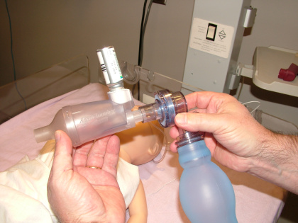AC-Mini-Photo-Lifestyle-In Use-With Resuscitation Bag
