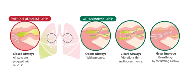 diagram comparing airways without aerobika opep device with aerobika opep device