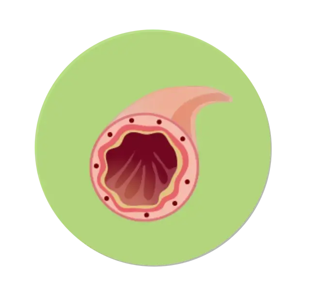 image depicting airway clogged with mucus