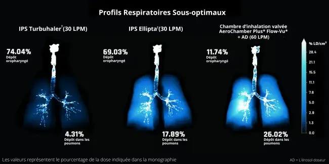 profils respiratoires sous-optimaux