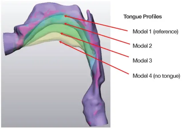 tongue profiles