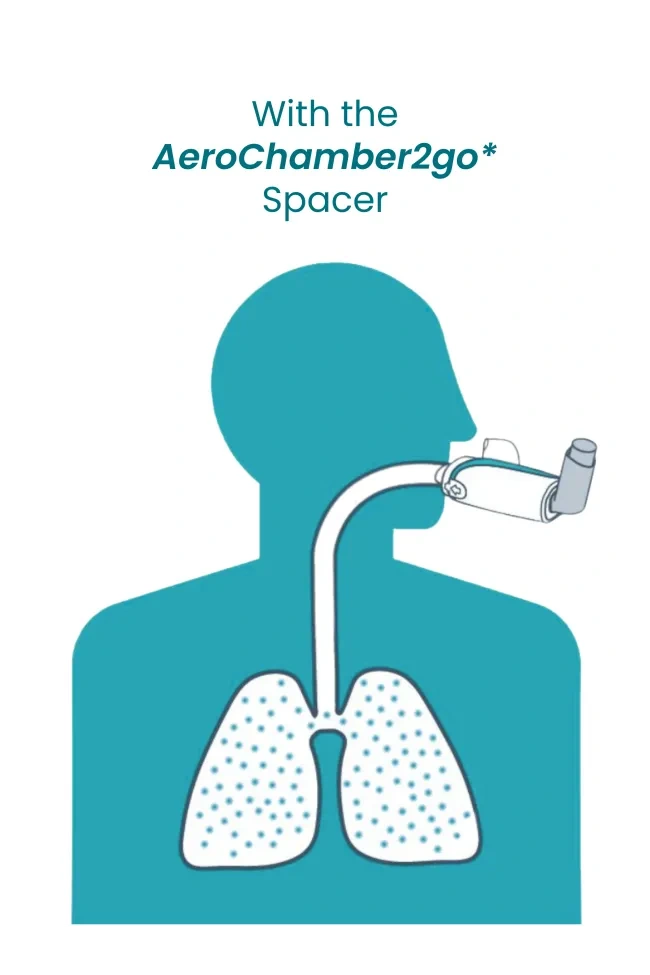 With the AeroChamber2go* Spacer