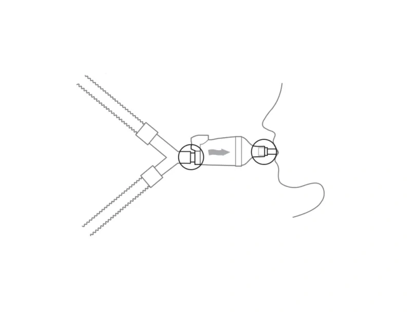 diagram showing how to disconnect the wye from the endotracheal tube