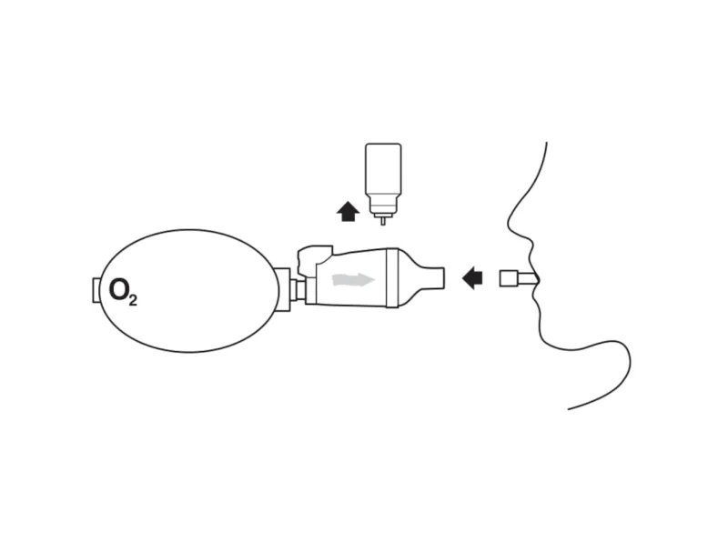 diagram depicting how to remove MDI canister from aerochamber mini