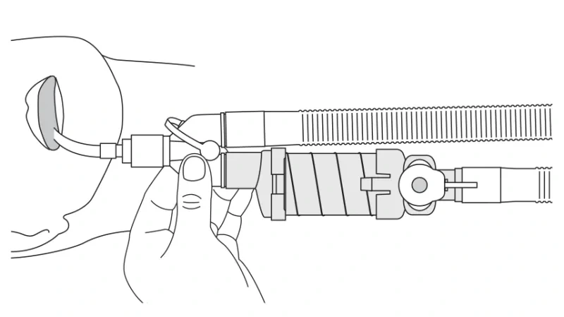 diagram depicting how to remove inspiratory limb from the wye of aerochamber vent holding chamber