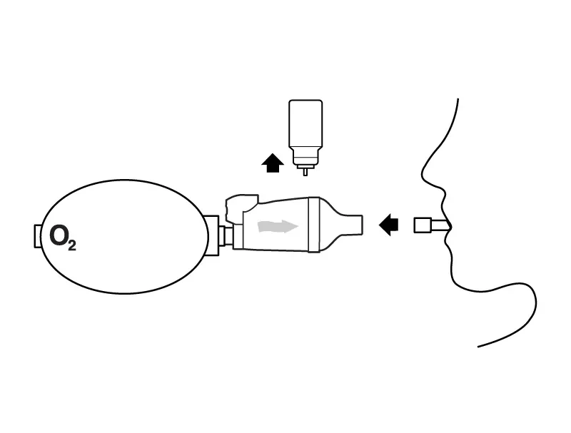 AeroChamber Mini with Resuscitation Bag IFU Step 6