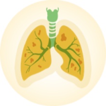 Living with Cystic Fibrosis