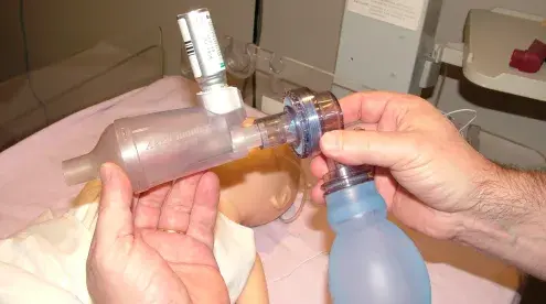 AC-Mini-Photo-Lifestyle-In Use-With Resuscitation Bag